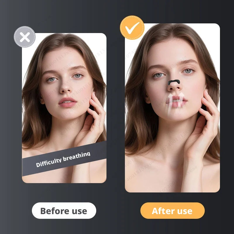 Nasal Dilator Sleep Nasal Breathing Dilators Starter Kit Nose Breathe Strips Nasal Strips Reduce Snoring Increase Air