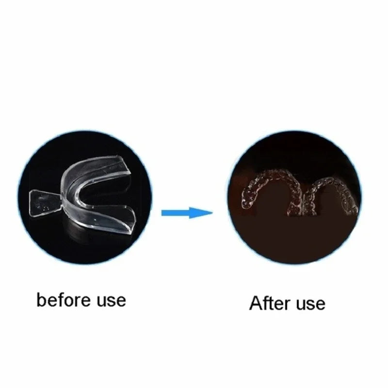 1/2/4PCS Anti Snoring Bruxism Sleeping Mouth Guard Night Guard Gum Shield Mouth Tray Stop Teeth Grinding Sleep Aid Health Care
