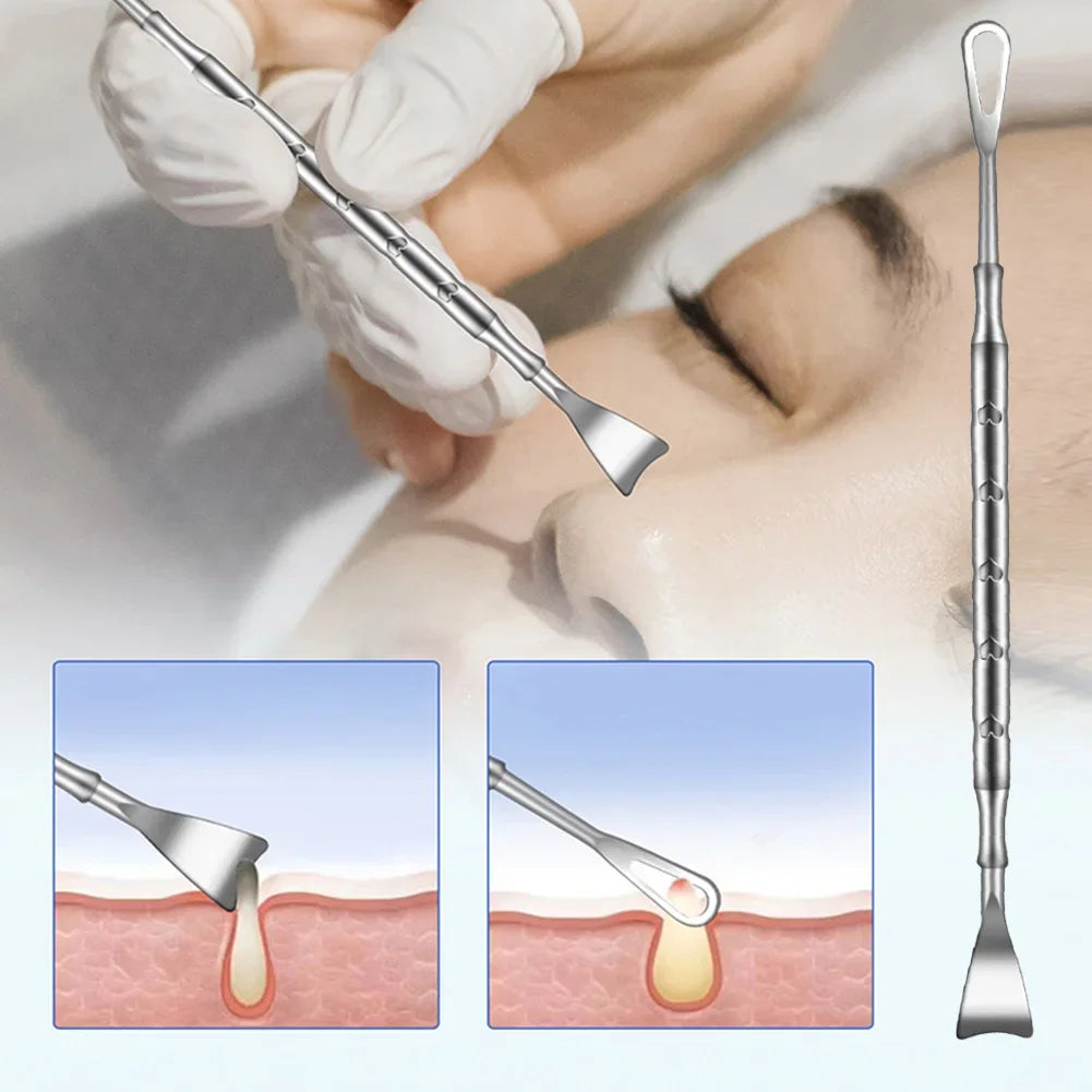 Double Head Stainless Steel Professional Blackhead Remover Blemish Extractor Tool Pimple Comedone Removal For Face
