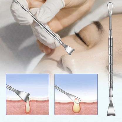 Double Head Stainless Steel Professional Blackhead Remover Blemish Extractor Tool Pimple Comedone Removal For Face