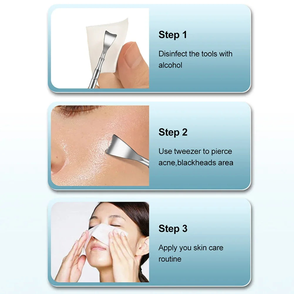 Double Head Stainless Steel Professional Blackhead Remover Blemish Extractor Tool Pimple Comedone Removal For Face