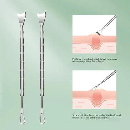 Double Head Stainless Steel Professional Blackhead Remover Blemish Extractor Tool Pimple Comedone Removal For Face