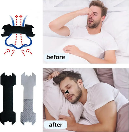 30/90/150Pcs, Anti Snoring Nose Patch, Extra Strength Nasal Strips Better Breathing Non-Invasive Easier Breath Sleep Aid Decive