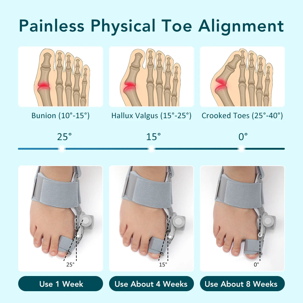 Toe Adjuster Orthotics Bone Thumb Adjustable Hammer Protector Hallux Valgus Adjuster Bunion Adjuster Orthopedic Tool Care