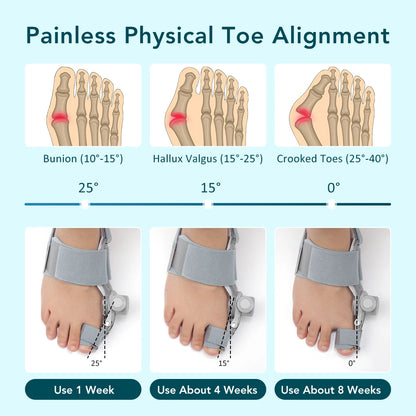 Toe Adjuster Orthotics Bone Thumb Adjustable Hammer Protector Hallux Valgus Adjuster Bunion Adjuster Orthopedic Tool Care