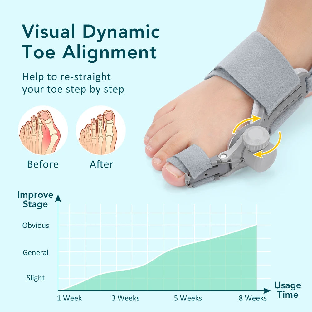 Toe Adjuster Orthotics Bone Thumb Adjustable Hammer Protector Hallux Valgus Adjuster Bunion Adjuster Orthopedic Tool Care