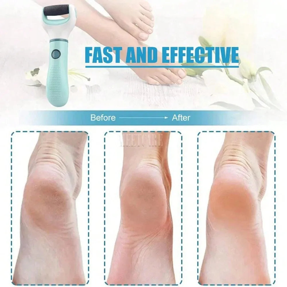 Foot File, Foot Scraper To Remove Calluses And Dead Skin, Foot Care Tools
