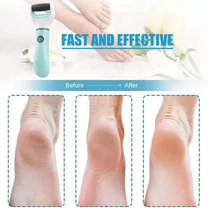 Foot File, Foot Scraper To Remove Calluses And Dead Skin, Foot Care Tools